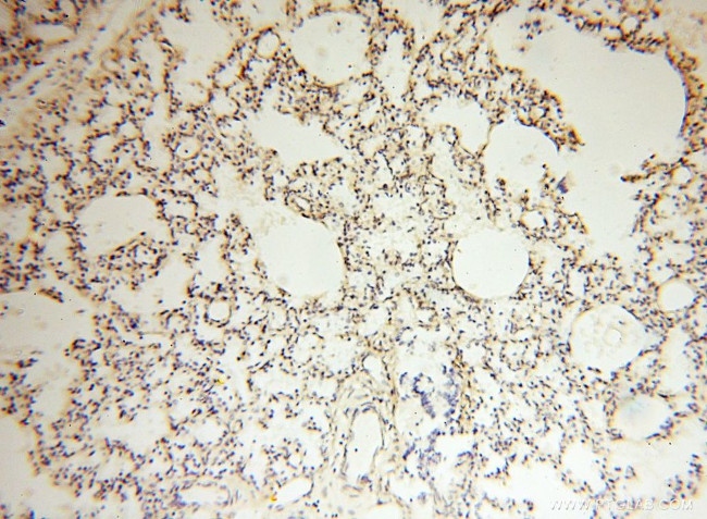 FBXL8 Antibody in Immunohistochemistry (Paraffin) (IHC (P))