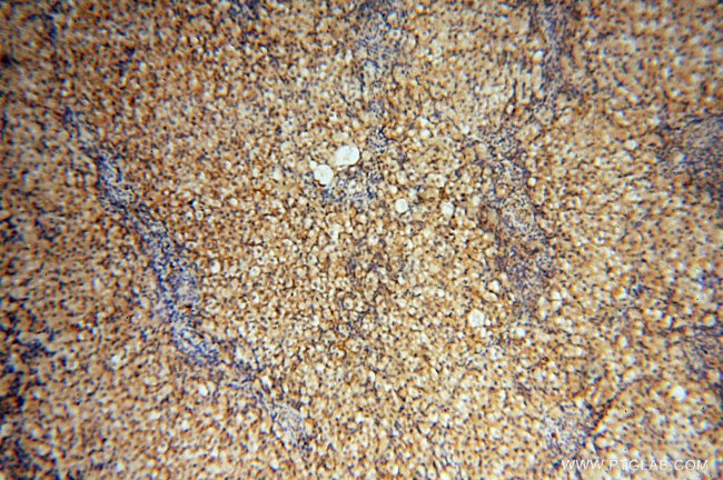 FBXL8 Antibody in Immunohistochemistry (Paraffin) (IHC (P))