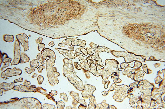 FBXL8 Antibody in Immunohistochemistry (Paraffin) (IHC (P))