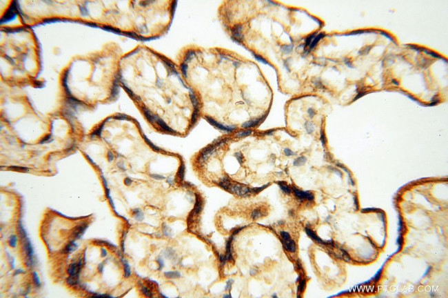 FBXL8 Antibody in Immunohistochemistry (Paraffin) (IHC (P))