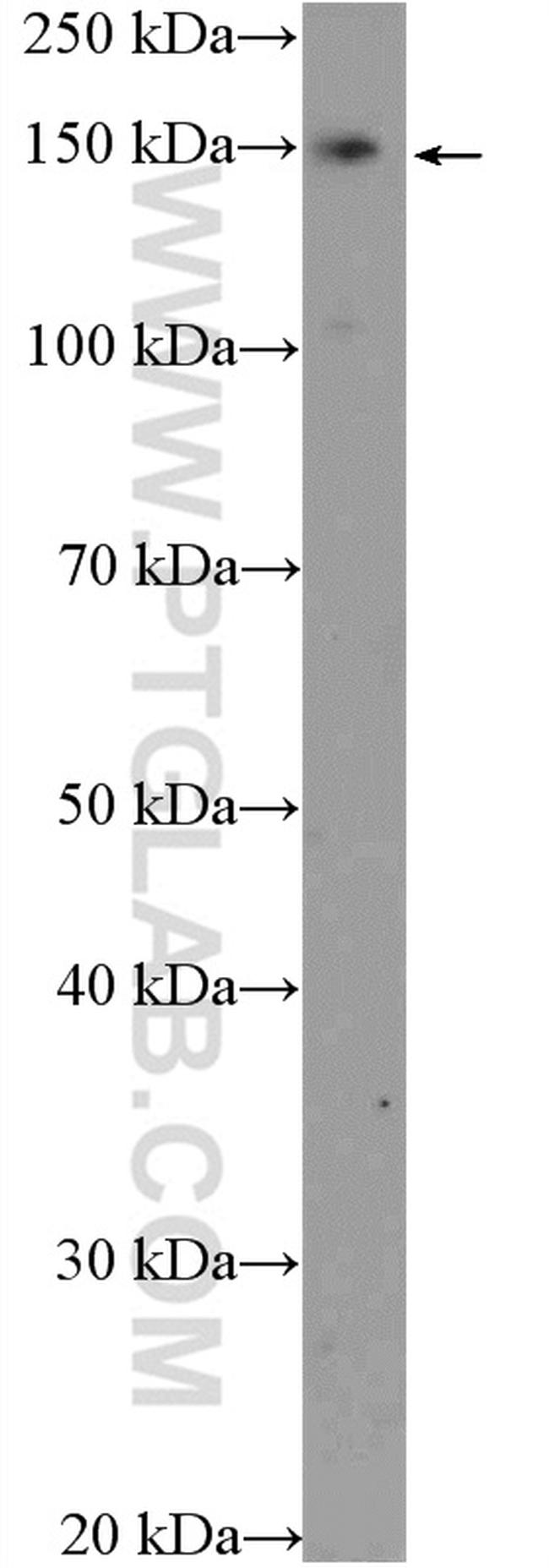 SUPT5H Antibody in Western Blot (WB)