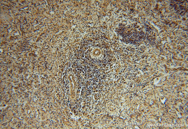 METTL6 Antibody in Immunohistochemistry (Paraffin) (IHC (P))