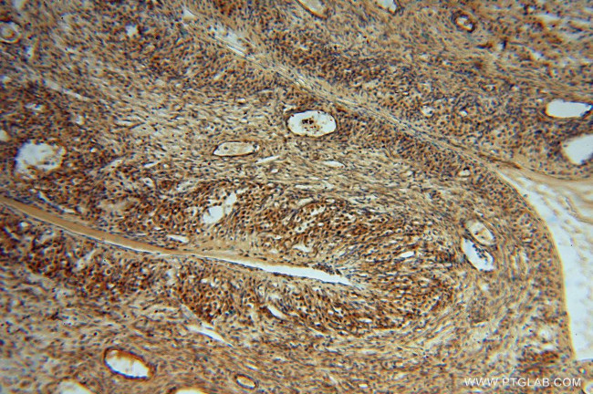 METTL6 Antibody in Immunohistochemistry (Paraffin) (IHC (P))