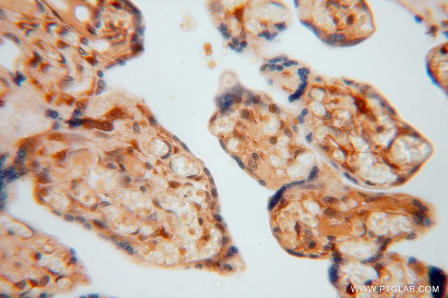 METTL6 Antibody in Immunohistochemistry (Paraffin) (IHC (P))