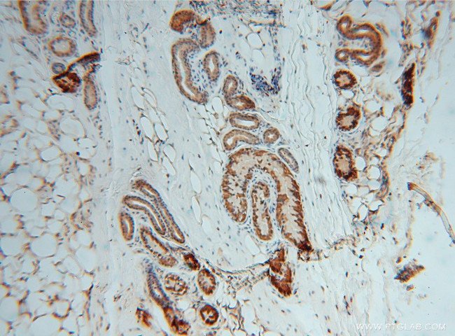 METTL6 Antibody in Immunohistochemistry (Paraffin) (IHC (P))