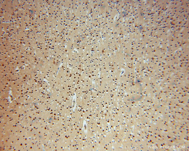 METTL6 Antibody in Immunohistochemistry (Paraffin) (IHC (P))