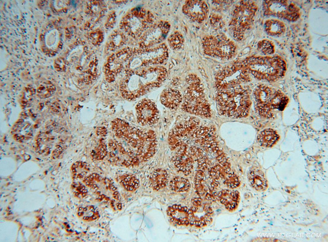 CTHRC1 Antibody in Immunohistochemistry (Paraffin) (IHC (P))