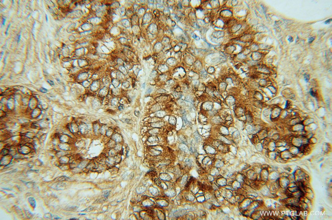 CTHRC1 Antibody in Immunohistochemistry (Paraffin) (IHC (P))