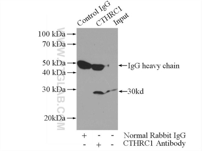 CTHRC1 Antibody in Immunoprecipitation (IP)