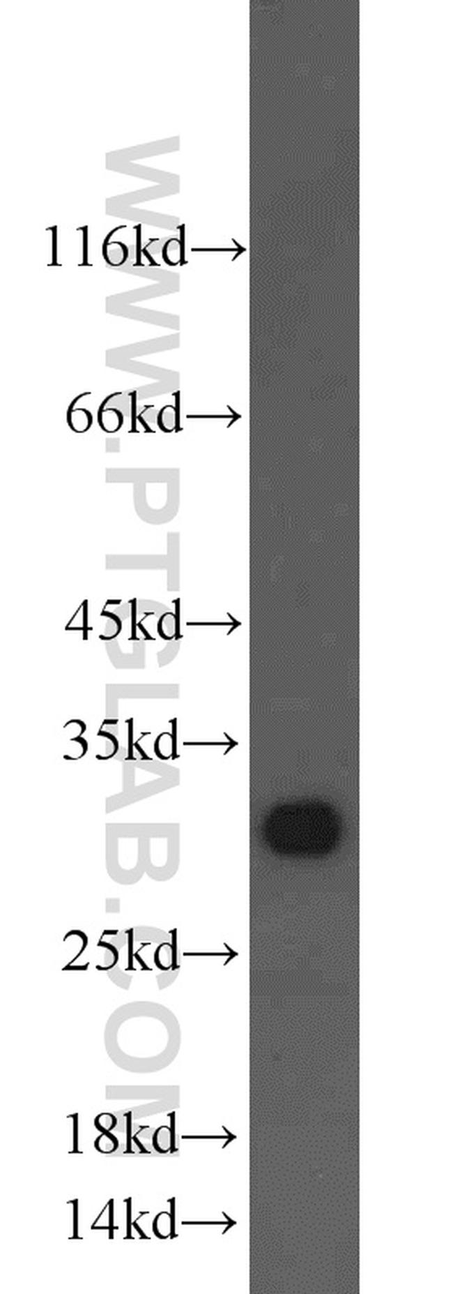 CTHRC1 Antibody in Western Blot (WB)