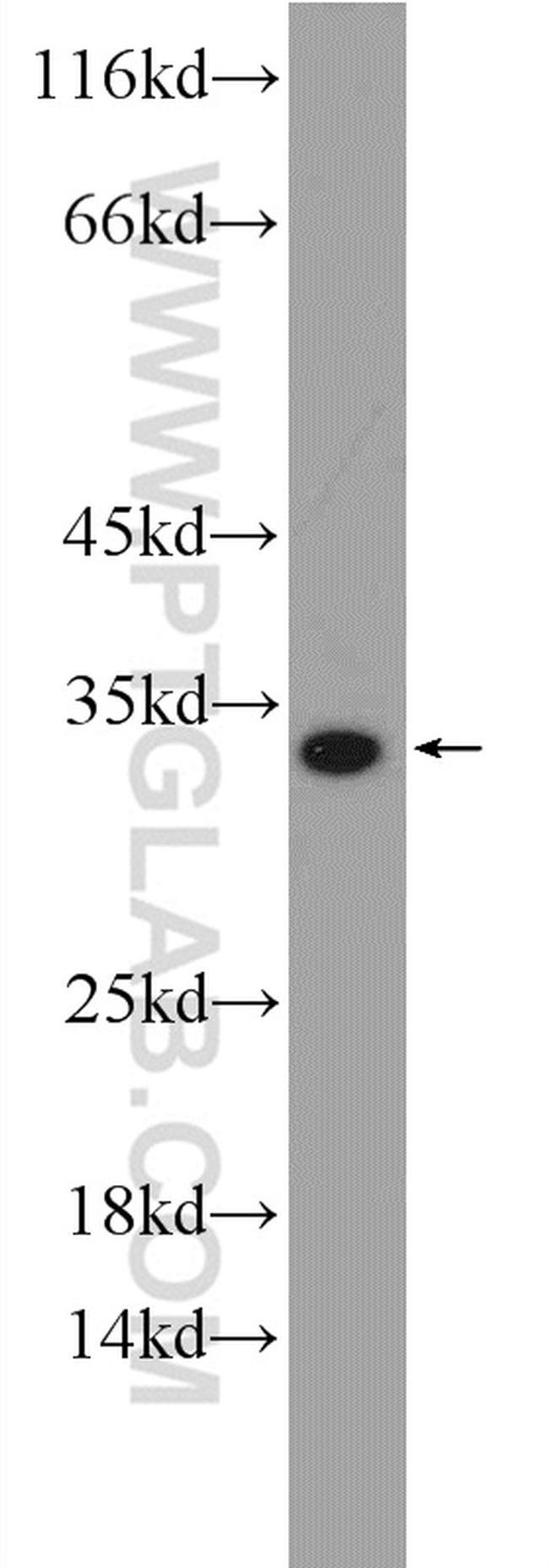 CTHRC1 Antibody in Western Blot (WB)