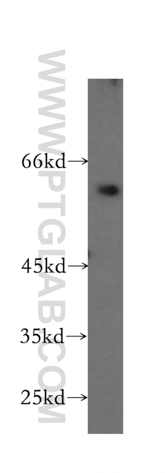CCKBR Antibody in Western Blot (WB)