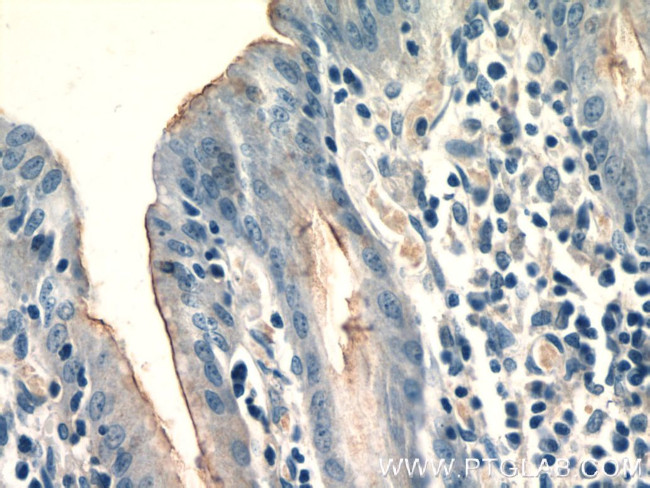 CCKAR Antibody in Immunohistochemistry (Paraffin) (IHC (P))