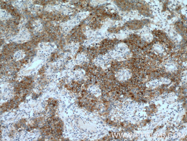 SMPDL3B Antibody in Immunohistochemistry (Paraffin) (IHC (P))