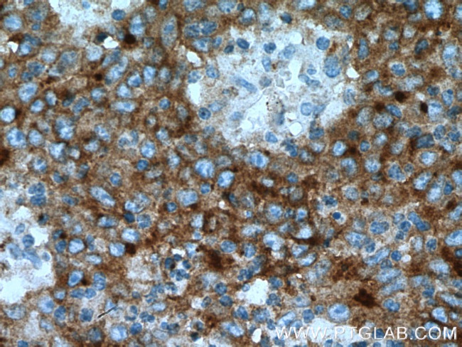 SMPDL3B Antibody in Immunohistochemistry (Paraffin) (IHC (P))