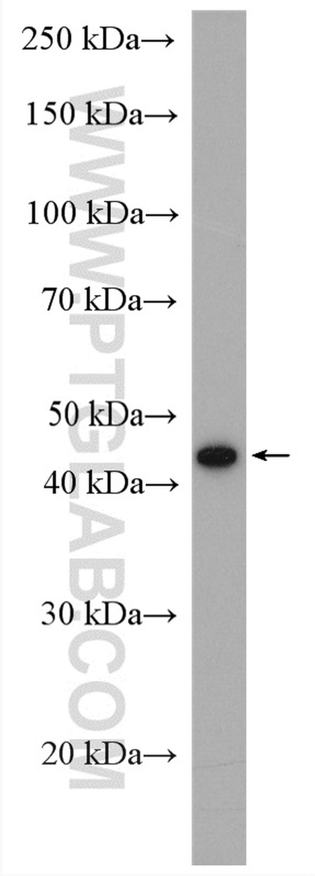 Napsin A Antibody in Western Blot (WB)