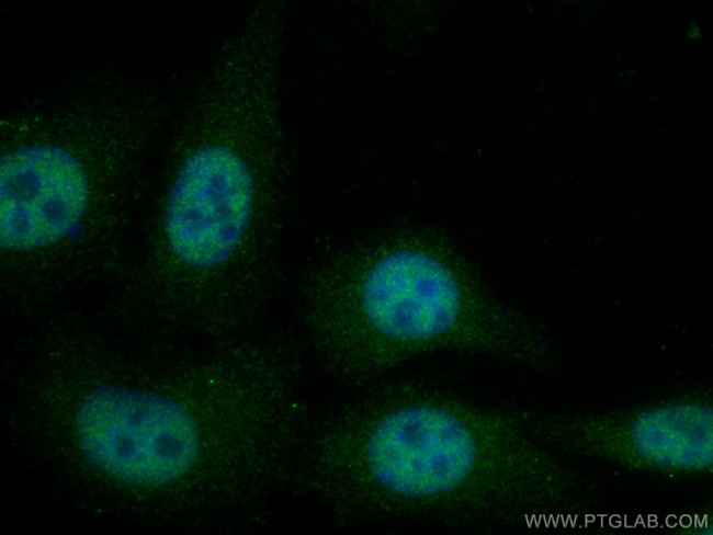 MED31 Antibody in Immunocytochemistry (ICC/IF)