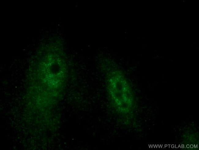 HEXIM2 Antibody in Immunocytochemistry (ICC/IF)