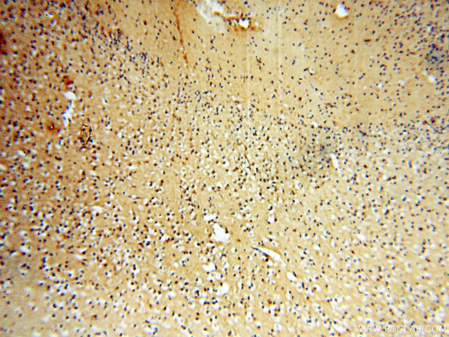 PITPNA Antibody in Immunohistochemistry (Paraffin) (IHC (P))