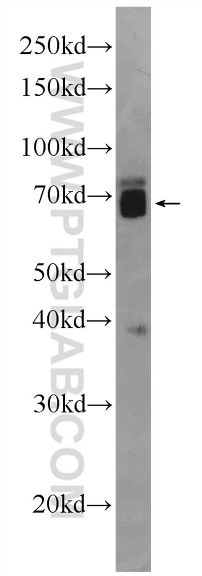 ZNF143 Antibody in Western Blot (WB)