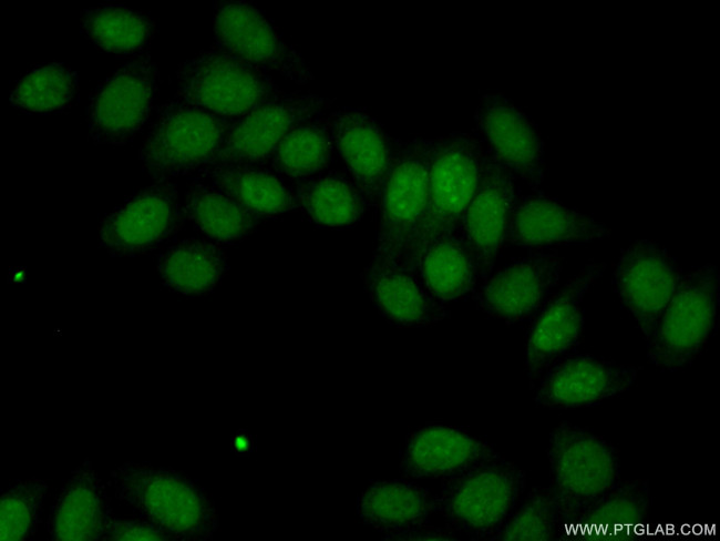 HDDC2 Antibody in Immunocytochemistry (ICC/IF)