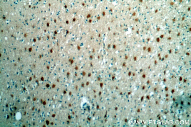 HDDC2 Antibody in Immunohistochemistry (Paraffin) (IHC (P))