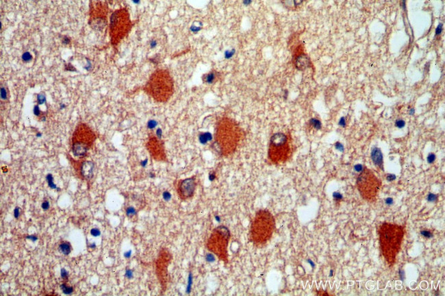 HDDC2 Antibody in Immunohistochemistry (Paraffin) (IHC (P))