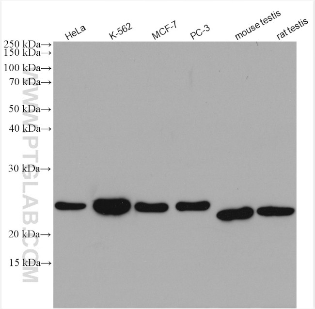 HDDC2 Antibody in Western Blot (WB)