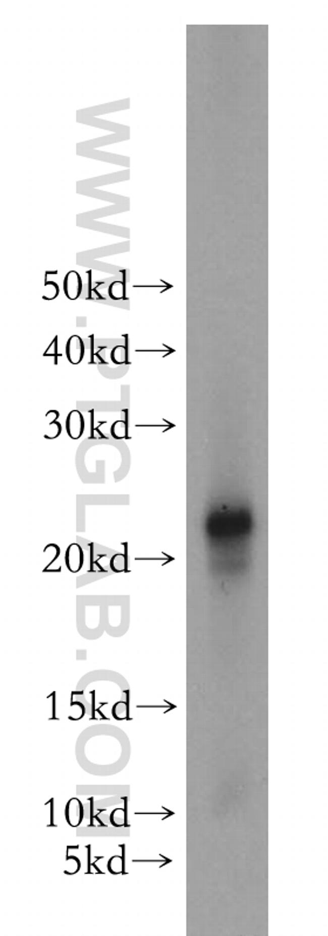 HDDC2 Antibody in Western Blot (WB)