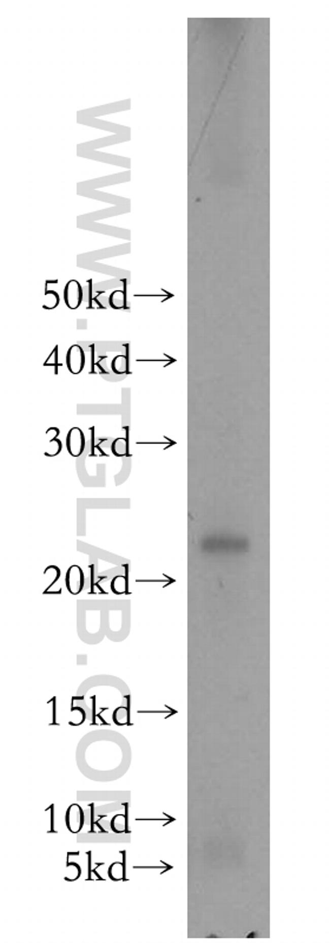 HDDC2 Antibody in Western Blot (WB)