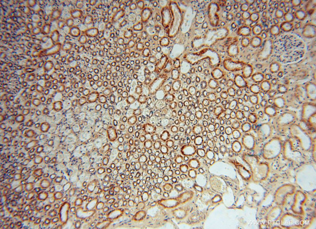 OCIAD1 Antibody in Immunohistochemistry (Paraffin) (IHC (P))