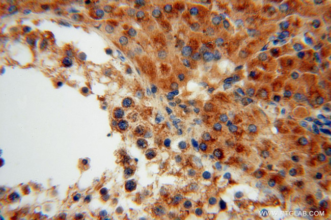 OCIAD1 Antibody in Immunohistochemistry (Paraffin) (IHC (P))