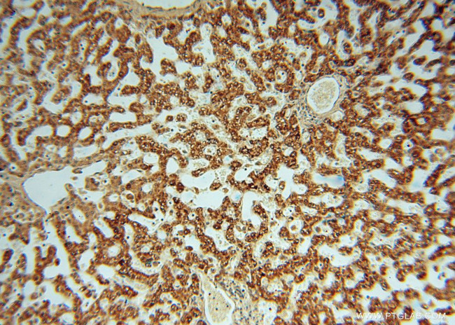 OCIAD1 Antibody in Immunohistochemistry (Paraffin) (IHC (P))