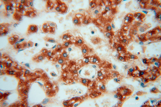 OCIAD1 Antibody in Immunohistochemistry (Paraffin) (IHC (P))