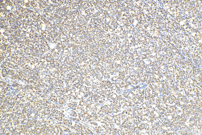 OCIAD1 Antibody in Immunohistochemistry (Paraffin) (IHC (P))