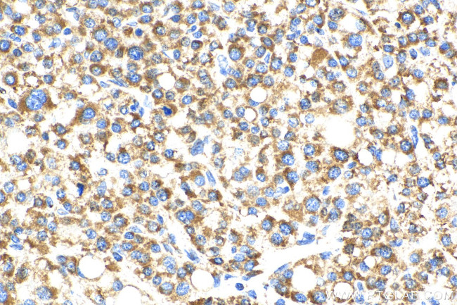 OCIAD1 Antibody in Immunohistochemistry (Paraffin) (IHC (P))