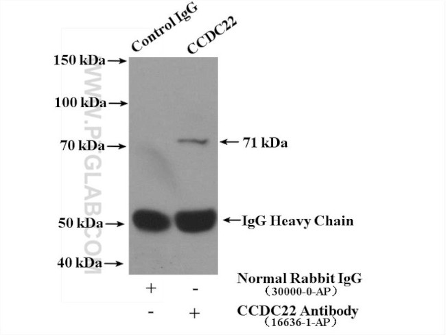 CCDC22 Antibody in Immunoprecipitation (IP)