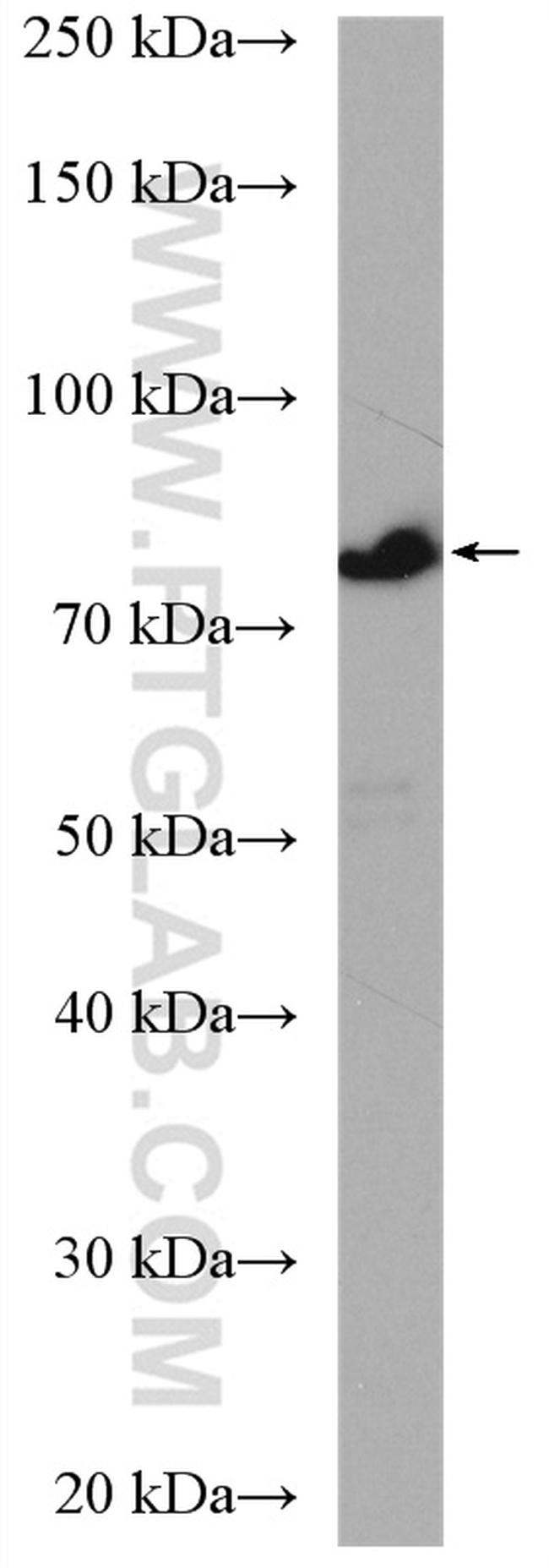 CCDC22 Antibody in Western Blot (WB)