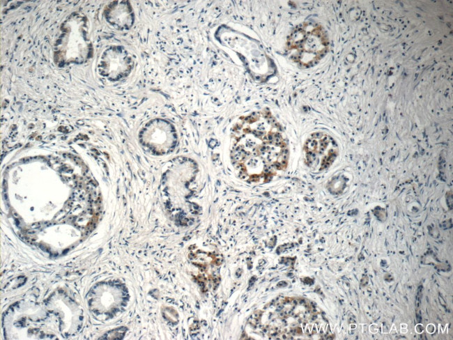 EPLIN Antibody in Immunohistochemistry (Paraffin) (IHC (P))