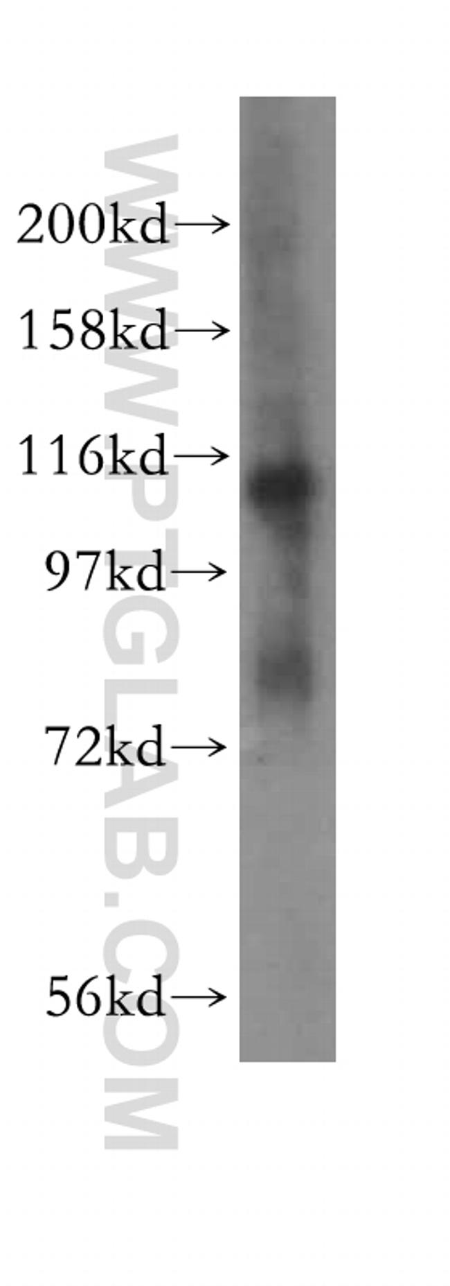 EPLIN Antibody in Western Blot (WB)