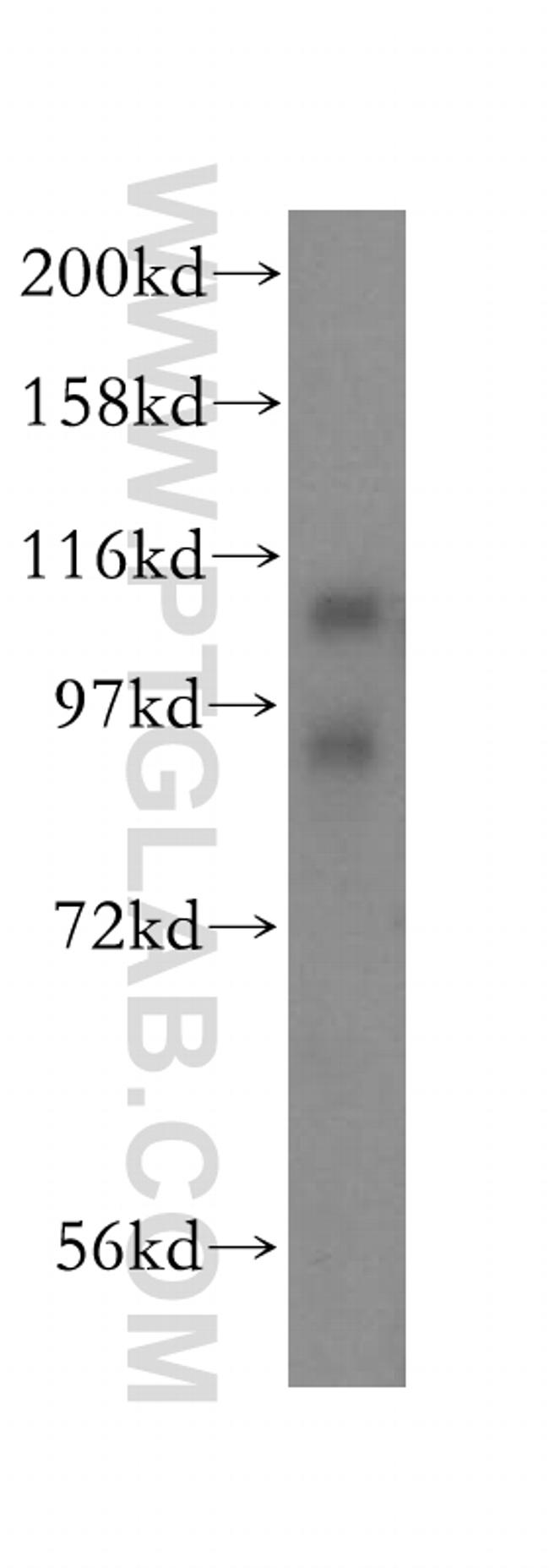 EPLIN Antibody in Western Blot (WB)