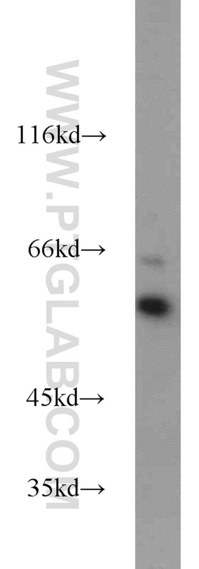 PPAR gamma Antibody in Western Blot (WB)