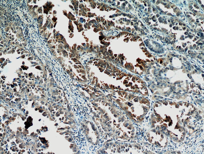 STAT2 Antibody in Immunohistochemistry (Paraffin) (IHC (P))