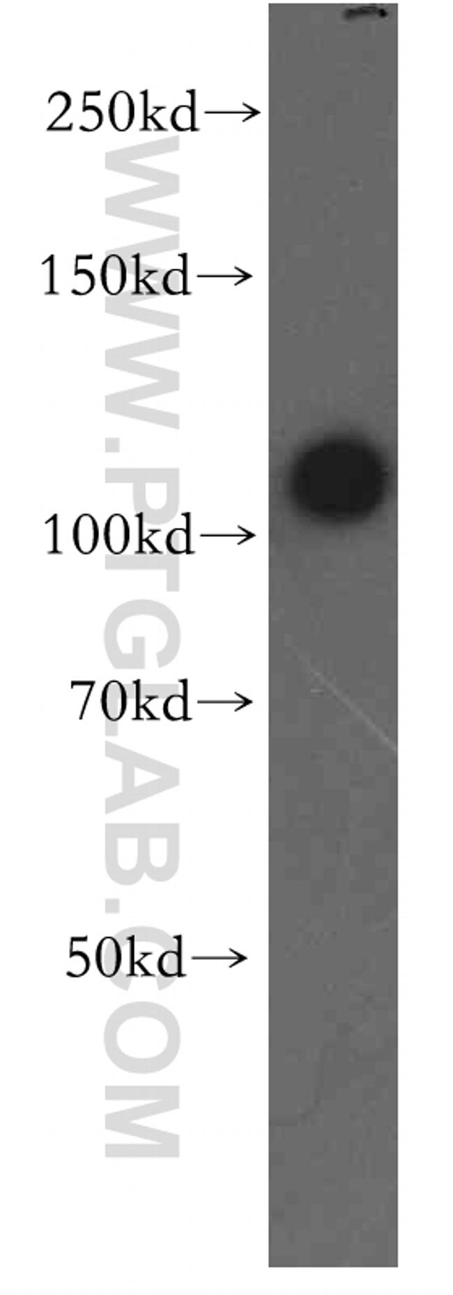 STAT2 Antibody in Western Blot (WB)