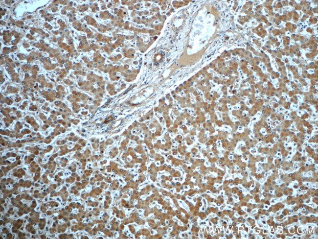 CKAP4 Antibody in Immunohistochemistry (Paraffin) (IHC (P))