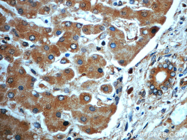 CKAP4 Antibody in Immunohistochemistry (Paraffin) (IHC (P))