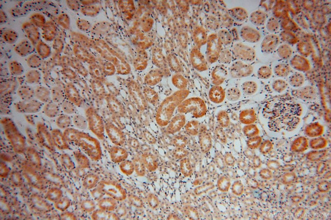 CKAP4 Antibody in Immunohistochemistry (Paraffin) (IHC (P))