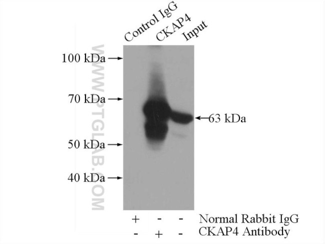 CKAP4 Antibody in Immunoprecipitation (IP)