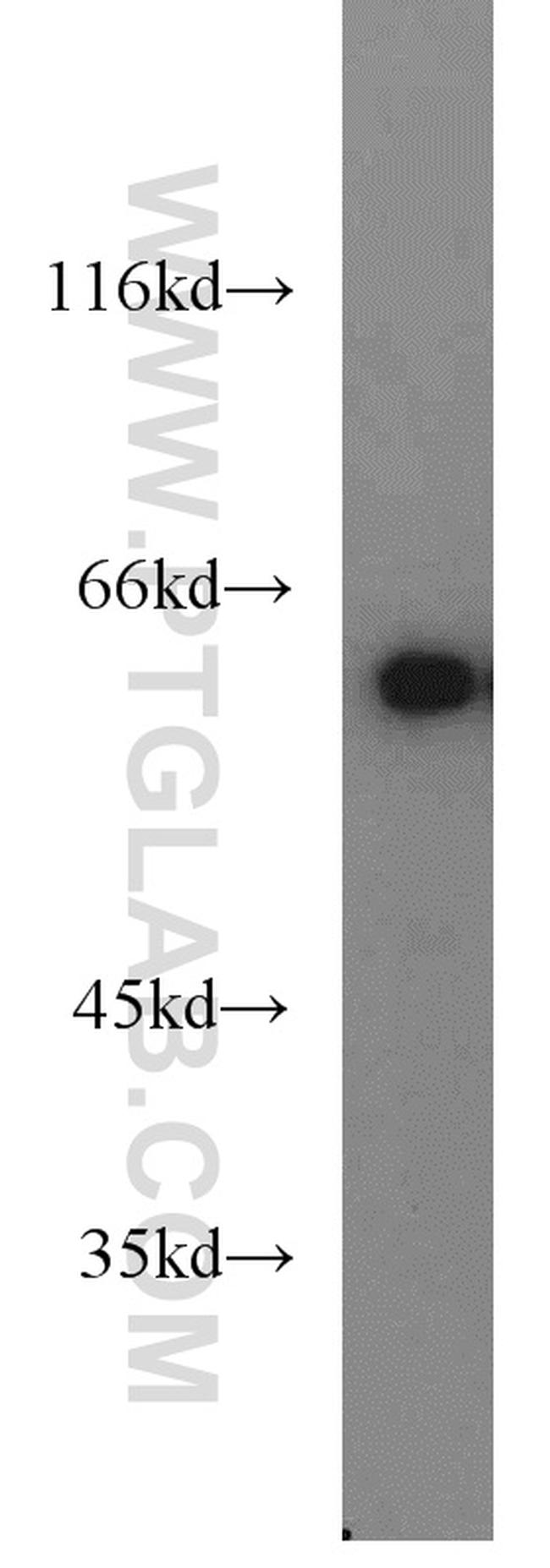 CKAP4 Antibody in Western Blot (WB)