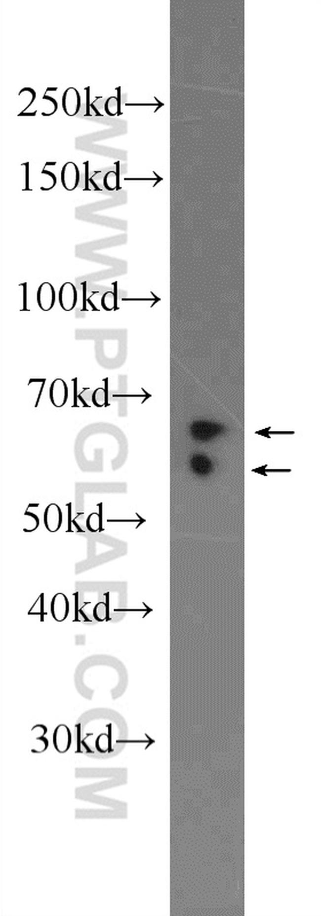 CKAP4 Antibody in Western Blot (WB)